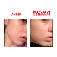 ANUA serum iluminador con niacinamida 10% + TXA 4% 30 ml