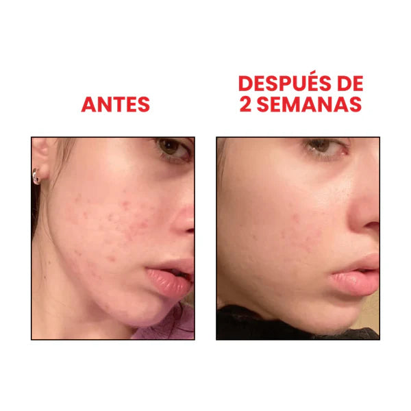 ANUA serum iluminador con niacinamida 10% + TXA 4% 30 ml
